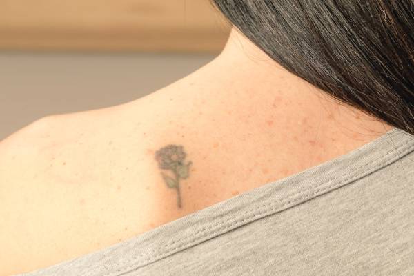 Side Effects Of Tattoo : Risks You Should Be Aware Of!